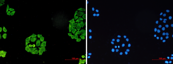 Surfeit Locus Protein 4 Rabbit mAb Antibody