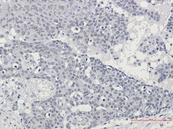 SPT5 Rabbit mAb Antibody