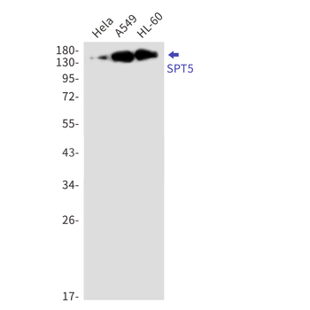 SPT5 Rabbit mAb Antibody