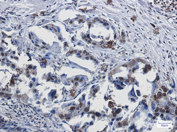 SUMO1 Rabbit Monoclonal Antibody