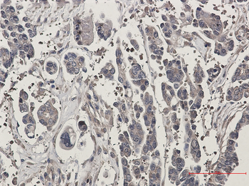 SPAK Rabbit Monoclonal Antibody