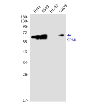 SPAK Rabbit Monoclonal Antibody