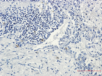 STK3 Rabbit mAb Antibody