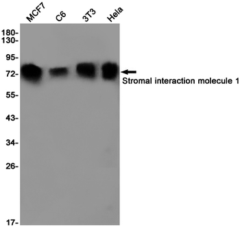 Stromal Interaction Molecule 1 Rabbit Monoclonal Antibody