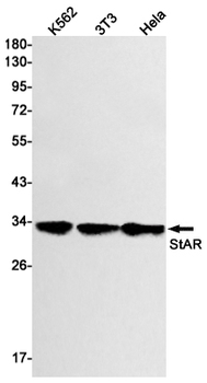 StAR Rabbit mAb Antibody