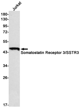 Somatostatin Receptor 3 Rabbit mAb Antibody