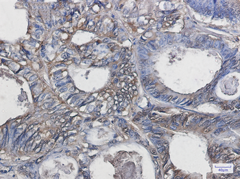 Superoxide Dismutase 1 Rabbit mAb Antibody