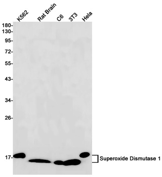Superoxide Dismutase 1 Rabbit mAb Antibody
