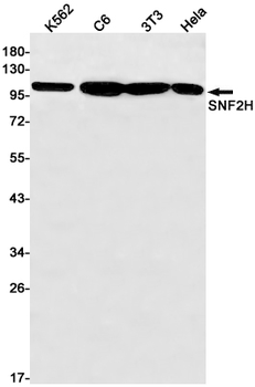 SMARCA5 Rabbit Monoclonal Antibody