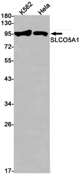SLCO5A1 Rabbit mAb Antibody