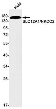 SLC12A1 Rabbit mAb Antibody