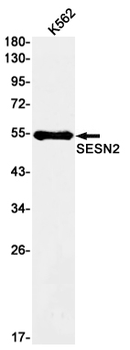 SESN2 Rabbit mAb Antibody