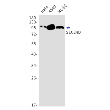SEC24D Rabbit mAb Antibody