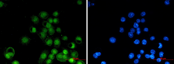 Retinoid X Receptor alpha Rabbit mAb Antibody