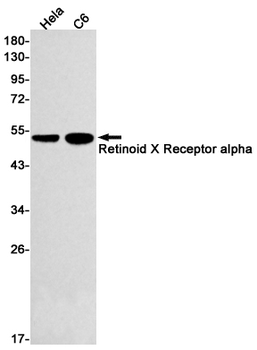 Retinoid X Receptor alpha Rabbit mAb Antibody