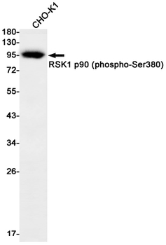 Phospho-RSK1 p90 (Ser380) Rabbit mAb