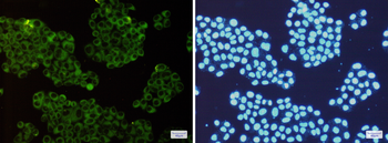 ROCK2 Rabbit Monoclonal Antibody