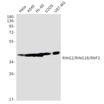 RING2 Rabbit Monoclonal Antibody