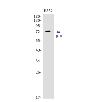 RIP Rabbit mAb Antibody