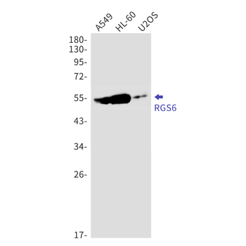 RGS6 Rabbit mAb Antibody