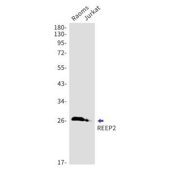 REEP2 Rabbit Monoclonal Antibody