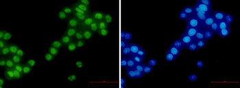 RBM3 Rabbit mAb Antibody