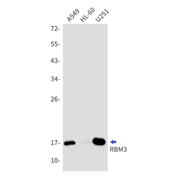 RBM3 Rabbit mAb