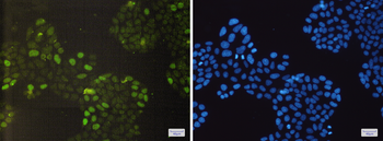 Rb Rabbit mAb Antibody