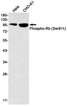 Rb (Phospho-Ser811) Rabbit mAb Antibody