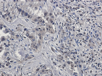 RASA1 Rabbit Monoclonal Antibody
