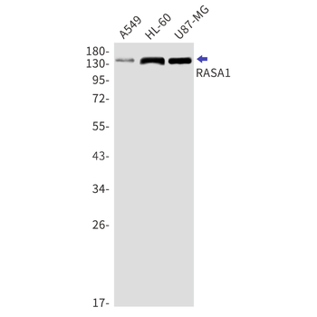 RASA1 Rabbit mAb