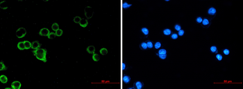 Raf1 Rabbit mAb Antibody