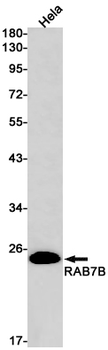 Rab7B Rabbit mAb Antibody