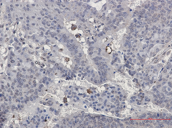 Paxillin Rabbit mAb
