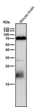 PCPTP1 Rabbit mAb