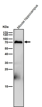 PCPTP1 Rabbit mAb