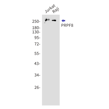 PRPF8 Rabbit mAb Antibody
