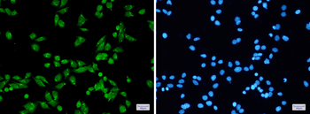 PRPF31 Rabbit mAb Antibody
