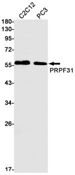 PRPF31 Rabbit mAb Antibody
