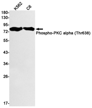 Phospho-PKC alpha (Thr638) Rabbit mAb