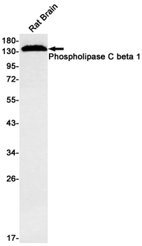 Phospholipase C beta 1 Rabbit mAb Antibody
