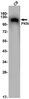 PKN1 Rabbit mAb Antibody