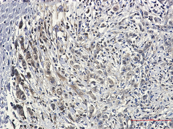 PIN1 Rabbit mAb Antibody