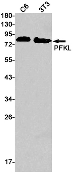 PFKL Rabbit mAb Antibody