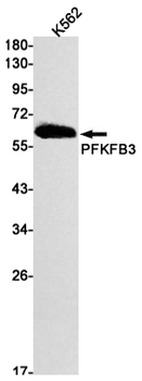 PFKFB3 Rabbit mAb