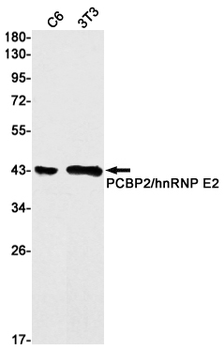 PCBP2 Rabbit mAb Antibody