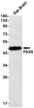 PAX6 Rabbit mAb Antibody
