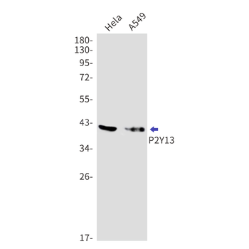 P2Y13 Rabbit mAb Antibody