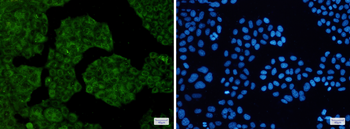 NUDT9 Rabbit mAb Antibody