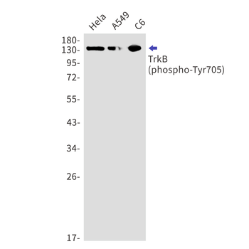 Phospho-TrkB (Tyr705) Rabbit mAb